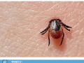 隨州市中心醫(yī)院提醒：小小蜱蟲需警惕！——發(fā)熱伴血小板減少綜合征科普知識